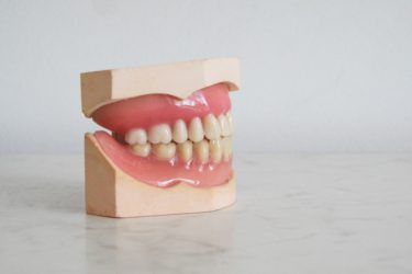 歯医者はヤブが多いと思う。